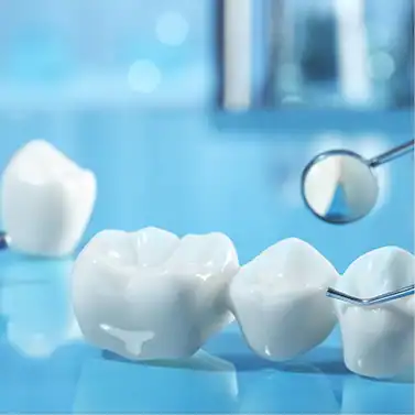 Dental crowns and bridges treatment at Agrim Dental Clinic Kathmandu