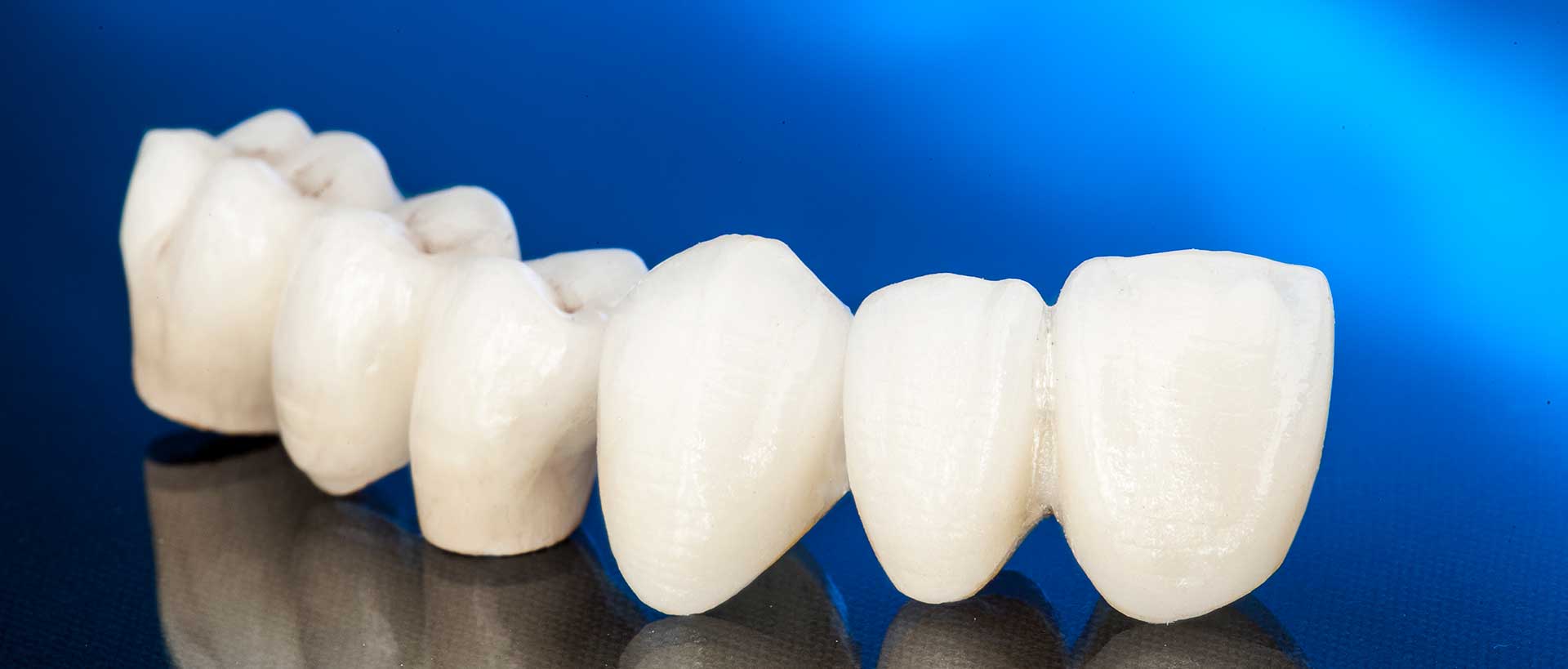 Zirconia Crown Treatment in Kathmandu at Agrim Dental Clinic